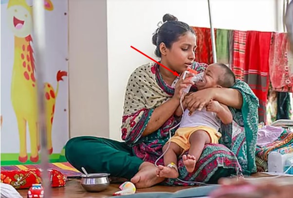 আবারও হাম উপসর্গে প্রাণ গেল আরও ৭ শিশুর, মৃত্যু বেড়ে ৯৫০ ।